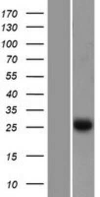 Western Blot: EFHD2 Overexpression Lysate (Adult Normal) [NBP2-06338] Left-Empty vector transfected control cell lysate (HEK293 cell lysate); Right -Over-expression Lysate for EFHD2.