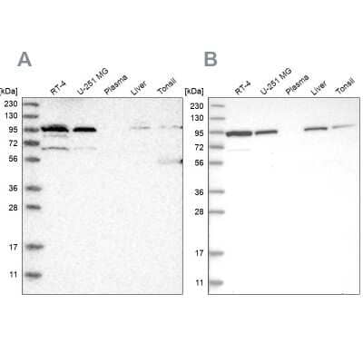 Western Blot: EFR3A Antibody [NBP1-81538] - Analysis using Anti-EFR3A antibody NBP1-81538 (A) shows similar pattern to independent antibody NBP1-81539 (B).
