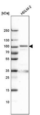 Western Blot: EFR3A Antibody [NBP1-81539] - Analysis in human cell line HDLM-2.
