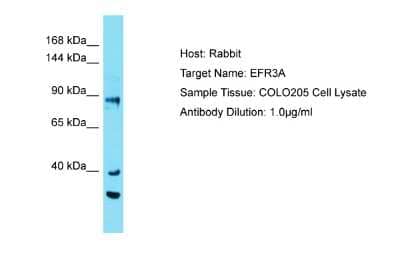 Western Blot: EFR3A Antibody [NBP2-87333] - Host: Rabbit. Target Name: EFR3A. Sample Tissue: Human COLO205 Whole Cell. Antibody Dilution: 1ug/ml