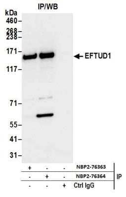 Immunoprecipitation: EFTUD1 Antibody [NBP2-76363] - Samples: Whole cell lysate (1.0 mg per IP reaction; 20% of IP loaded) from RKO cells prepared using NETN lysis buffer. Antibodies: Affinity purified rabbit anti-EFTUD1 antibody NBP2-76363 used for IP at 15 ul per reaction. EFTUD1 was also immunoprecipitated by rabbit anti-EFTUD1 antibody NBP2-76364. For blotting immunoprecipitated EFTUD1, NBP2-76364 was used at 1:1000. Detection: Chemiluminescence with an exposure time of 3 seconds.