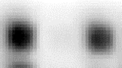 Dot Blot: EGF Antibody [26610002] - Protein samples (left spot: 293T cell lysate; right spot: Jurkat cell lysate) were printed on membranes at 40 ng/spot.  The membrane was incubated with anti-EGF antibody (1:4000 dilution) and then probed anti-rabbit IgG-HRP.  Signals were acquired with a CCD camera.  Data courtesy of a SDI customer.