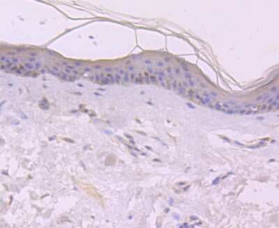 Immunohistochemistry-Paraffin: EGF Antibody (JA14-15) [NBP2-66819] - Analysis of paraffin-embedded human skin tissue using anti-EGF antibody. Counter stained with hematoxylin.