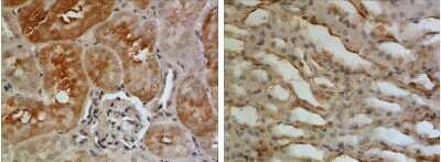 Immunohistochemistry-Paraffin: EGF Antibody (RM0078-2M13) [NBP1-21708] - The Kidney tissue samples from the Folic Acid induced kidney injury model were fixed using 4% PFA at 4C for overnight and embeded in paraffin. 4um section was sublected to IHC with NBP1-21708