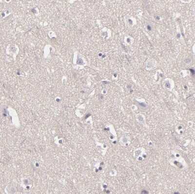 Immunohistochemistry-Paraffin EGF-L6 Antibody - BSA Free