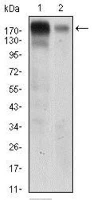 Western Blot: EGF R/ErbB1 Antibody (5E10D3) [NBP2-37326] - Western blot analysis using EGFR mouse mAb against A431 (1) AND Hela (2) cell lysate.