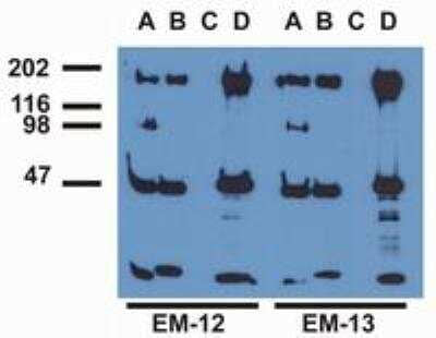 Immunoprecipitation: EGF R/ErbB1 [p Tyr1173] Antibody (EM-13) [NBP1-44893] - EGFR from EGF-treated A431 cells by monoclonal antibodies EM-12 (A), EM-13 (B), a commercial anti-EGFR polyclonal antibody (C) and anti-EGFR monoclonal (D). The precipitates were immunoblotted with EM-12 or EM-13 antibody, and goat anti-mouse-HRP.  