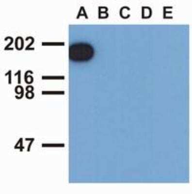 Western Blot: EGF R/ErbB1 [p Tyr1173] Antibody (EM-13) [NBP1-44893] - Analysis of EGFR (phospho-Tyr1173) by mouse monoclonal antibody EM-13 in EGF-treated A431 (A), CALU-3 (B), MCF-7 (C), Jurkat (D) and Ramos (E) cell lines (reduced conditions). 