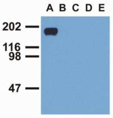 Western Blot: EGF R/ErbB1 [p Tyr992] Antibody (EM-12) [NBP1-44894] - Analysis of EGFR (phospho-Tyr992) by mouse monoclonal antibody EM-12 in EGF-treated A431 (A), CALU-3 (B), MCF-7 (C), Jurkat (D) and Ramos (E) cell lines (reduced conditions). 