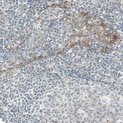Immunohistochemistry-Paraffin: EGFR Antibody (CL0815) [NBP2-52952] - Staining of human tonsil shows moderate membranous immunoreactivity in squamous epithelial cells.