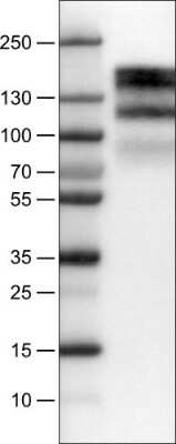 Western Blot: EGFR Antibody (CL0822) [NBP2-52953] - Lane 1: Marker [kDa], Lane 2: Human cell line A431