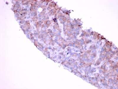 Immunohistochemistry-Paraffin: EGFR Antibody (GFR/1667) - Azide and BSA Free [NBP2-54310] - Formalin-fixed, paraffin-embedded human Bladder stained with EGFR Antibody (GFR/1667).
