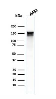 Western Blot: EGFR Antibody (GFR/1667) - Azide and BSA Free [NBP2-54310] - Western Blot Analysis of A431 cell lysate using EGFR antibody (GFR/1667).