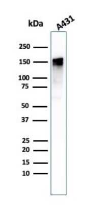 Western Blot: EGFR Antibody (GFR/1708) - Azide and BSA Free [NBP2-54330] - Western Blot Analysis of A431 cell lysate using EGFR antibody (GFR/1708).