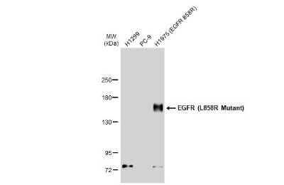 Western Blot: EGFR Antibody (HL1022) - L858R Mutant [NBP3-13683] - Various whole cell extracts were separated by 5% SDS-PAGE, and the membrane was blotted with EGFR (L858R Mutant) antibody [HL1022] (NBP3-13683) diluted at 1:1000. The HRP-conjugated anti-rabbit IgG antibody (NBP2-19301) was used to detect the primary antibody.