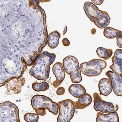 Immunohistochemistry-Paraffin: EGFR Antibody [NBP1-84815] - Staining of human placenta shows moderate membranous positivity in trophoblastic cells.