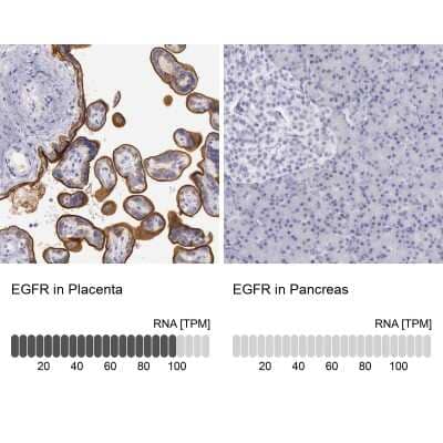 Immunohistochemistry-Paraffin: EGFR Antibody [NBP1-84815] - Staining in human placenta and pancreas tissues . Corresponding EGFR RNA-seq data are presented for the same tissues.