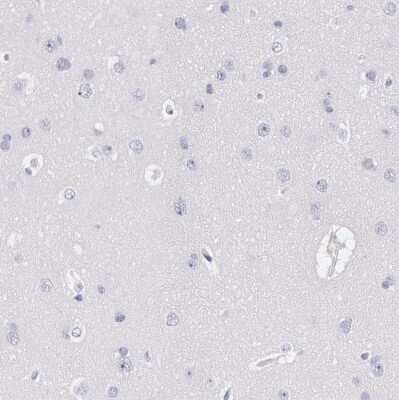 Immunohistochemistry-Paraffin: EGFR Antibody [NBP1-84815] - Staining of human cerebral cortex shows no positivity in neurons as expected.