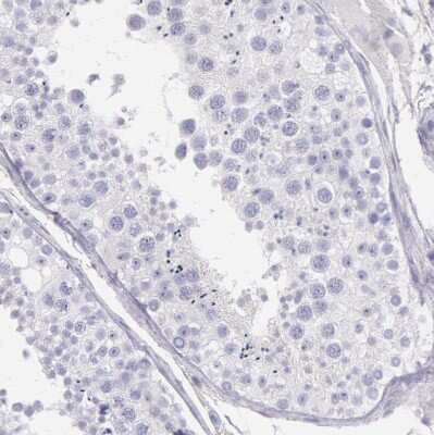 <b>Orthogonal Strategies Validation. </b>Immunohistochemistry-Paraffin: EGFR Antibody [NBP1-84815] - Staining of human testis shows no in cells in seminiferous ducts as expected.