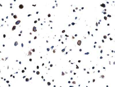 Immunohistochemistry-Paraffin: EGFR Antibody (RM380) - L858R [NBP2-89093] - Immunohistochemical staining of formalin fixed and paraffin embedded H1975 cell section using Anti-EGFR(L858R) Rabbit Monoclonal Antibody (Clone RM380) at a 1:100 dilution.