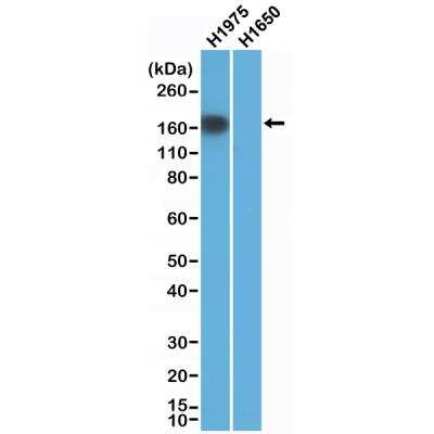 Western Blot: EGFR Antibody (RM380) - L858R [NBP2-89093] - Western Blot of H1975 and H1650 cells lysate using anti-EGFR(L858R) rabbit monoclonal antibody (Clone RM380) at a 1:1000 dilution.