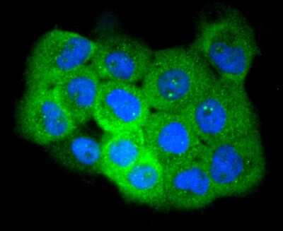 Immunocytochemistry/Immunofluorescence: EGFR [p Ser695] Antibody (SN07-36) [NBP2-67684] - Staining Phospho-EGFR(S695) in A431 cells (green). The nuclear counter stain is DAPI (blue). Cells were fixed in paraformaldehyde, permeabilised with 0.25% Triton X100/PBS.