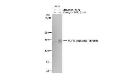 Western Blot: EGFR [p Thr669] Antibody (GT1361) [NBP3-13645] - Untreated (-) and treated (+) A431 whole cell extracts (30 ug) were separated by 5% SDS-PAGE, and the membrane was blotted with EGFR (phospho Thr669) antibody [GT1361] (NBP3-13645) diluted at 1:500. The HRP-conjugated anti-mouse IgG antibody (NBP2-19382) was used to detect the primary antibody.