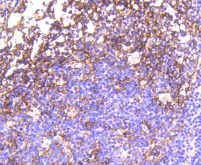 Immunohistochemistry-Paraffin: EGFR [p Tyr1092] Antibody (SJ0194) [NBP2-67411] - Analysis of paraffin-embedded human tonsil tissue using anti-Phospho-EGFR(Y1092) antibody. Counter stained with hematoxylin.