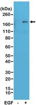 Western Blot: EGFR [p Tyr1173] Antibody (RM269) [NBP2-61528] - Western Blot of A431 cell nontreated (-) or treated (+) with EGF, using NBP2-61528, showed Phospho-EGFR (Tyr1173) in EGF-treated A431 cells.