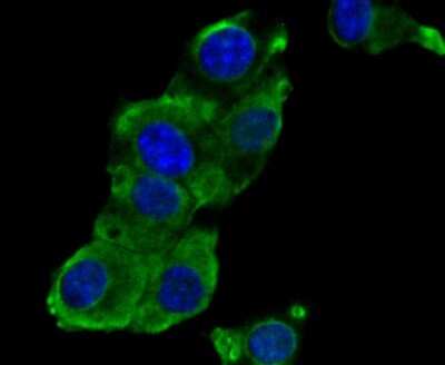 Immunocytochemistry/Immunofluorescence: EGFR [p Tyr1173] Antibody (SC57-04) [NBP2-67582] - Staining Phospho-EGFR (pY1173) in untreated B-6F1 cells (green). The nuclear counter stain is DAPI (blue). Cells were fixed in paraformaldehyde, permeabilised with 0.25% Triton X100/PBS.