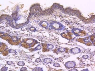Immunohistochemistry-Paraffin: EGFR [p Tyr1173] Antibody (SC57-04) [NBP2-67582] - Analysis of paraffin-embedded mouse skin tissue using anti- Phospho-EGFR(pY1173) antibody. Counter stained with hematoxylin.