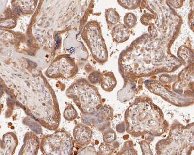 Immunohistochemistry-Paraffin: EGFR [p Tyr1173] Antibody (SC57-04) [NBP2-67582] - Immunohistochemical analysis of paraffin-embedded human placenta tissue using anti-EGFR antibody. The section was pre-treated using heat mediated antigen retrieval with Tris-EDTA buffer (pH 8.0-8.4) for 20 minutes. The tissues were blocked in 5% BSA for 30 minutes at room temperature, washed with ddH2O and PBS, and then probed with the primary antibody (ET1610-4, 1/50) for 30 minutes at room temperature. The detection was performed using an HRP conjugated compact polymer system. DAB was used as the chromogen. Tissues were counterstained with hematoxylin and mounted with DPX.
