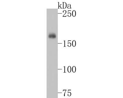 Western Blot: EGFR [p Tyr1173] Antibody (SC57-04) [NBP2-67582] - ICC staining of Phospho-EGFR (pY1173) in untreated A431 cells (green). Formalin fixed cells were permeabilized with 0.1% Triton X-100 in TBS for 10 minutes at room temperature and blocked with 1% Blocker BSA for 15 minutes at room temperature. Cells were probed with the primary antibody (1/50) for 1 hour at room temperature, washed with PBS. Alexa Fluor (TM) 488 Goat anti-Rabbit IgG was used as the secondary antibody at 1/1,000 dilution. The nuclear counter stain is DAPI (blue).