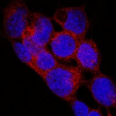 Immunocytochemistry/Immunofluorescence: EGLN1/PHD2 Antibody (2445B) - Azide and BSA Free [NBP2-80713] - EGLN1/PHD2 was detected in immersion fixed WM-115 human malignant melanoma cell line using Rabbit Anti-EGLN1/PHD2 Monoclonal Antibody (Catalog #NBP2-76810) at 3 ug/mL for 3 hours at room temperature. Cells were stained using the NorthernLights(TM) 557-conjugated Anti-Rabbit IgG Secondary Antibody (red; Catalog # NL004) and counterstained with DAPI (blue). Specific staining was localized to cell cytoplasm and nuclei. Image from the standard format of this antibody.