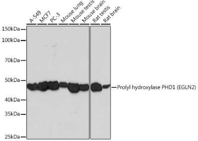 Western Blot：EGLN2/PHD1抗体（2G9M7）[NBP3-16265]-使用1:1000稀释度的EGLN2/PHD1兔单克隆抗体（NBP3-1626）分析各种细胞系的提取物。二级抗体：HRP山羊抗Rabbit IgG（H+L），1:10000稀释。裂解物/蛋白质：每车道25 ug。封闭缓冲液：TBST中3%脱脂奶粉。检测：ECL基本试剂盒。曝光时间：3min。