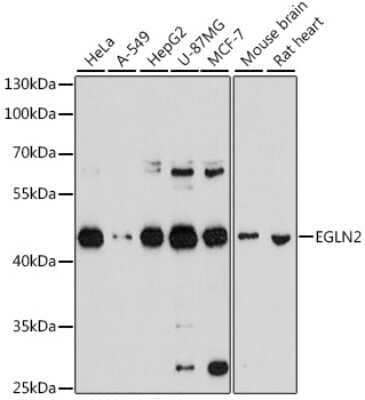 Western Blot：EGLN2/PHD1抗体[NBP2-92974]-使用1:1000稀释度的EGLN2/PHD1分析各种细胞系的提取物。二级抗体：HRP山羊抗Rabbit IgG（H+L），1:10000稀释。裂解物/蛋白质：每车道25 ug。封闭缓冲液：TBST中3%脱脂奶粉。检测：ECL基本试剂盒。曝光时间：30s。