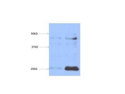 Western Blot: EGLN3/PHD3 Antibody (EG188e/d5) - Azide and BSA Free [NBP2-80715] - PHD3 expression in SK-N-BE(2) whole cell lysates. Cells were treated in normoxia (left) and in hypoxia (right). Image from verified customer review. Image from the standard format of this antibody.