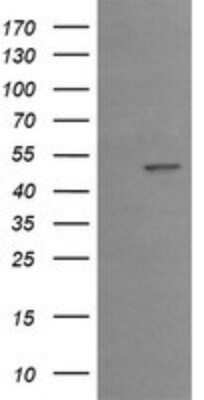 Western Blot: EGR2 Antibody (OTI1B12) - Azide and BSA Free [NBP2-70624] - Analysis of HEK293T cells were transfected with the pCMV6-ENTRY control (Left lane) or pCMV6-ENTRY EGR2.