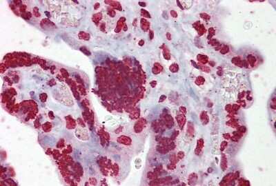 Immunohistochemistry: EGR3 Antibody [NBP2-82978] - Immunohistochemistry with Placenta tissue at an antibody concentration of 5ug/ml using anti-EGR3 antibody