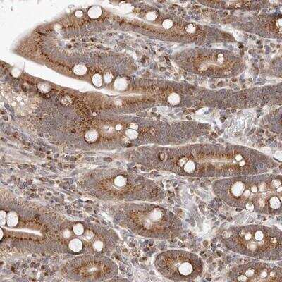 Immunohistochemistry-Paraffin: EGR3 Antibody [NBP1-80903] - Staining of human duodenum shows moderate granular cytoplasmic positivity in glandular cells.