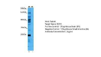 Western Blot: EGR3 Antibody [NBP2-82982] - Host: Rabbit. Target: EGR3. Positive control (+): Mouse Brain (M-BR). Negative control (-): Mouse Small Intestine (M-IN). Antibody concentration: 2ug/ml