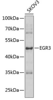 Western Blot: EGR3 Antibody [NBP2-92512] - Analysis of extracts of SKOV3 cells, using EGR3 antibody at 1:1000 dilution.Secondary antibody: HRP Goat Anti-Rabbit IgG (H+L) at 1:10000 dilution.Lysates/proteins: 25ug per lane. Blocking buffer: 3% nonfat dry milk in TBST.Detection: ECL Enhanced Kit. Exposure time: 30s.