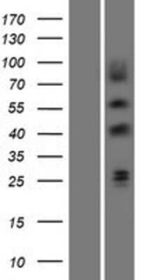 Western Blot: EGR3 Overexpression Lysate (Adult Normal) [NBP2-07872] Left-Empty vector transfected control cell lysate (HEK293 cell lysate); Right -Over-expression Lysate for EGR3.