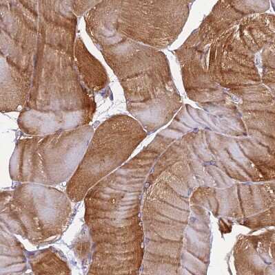 Immunohistochemistry-Paraffin EHBP1L1 Antibody - BSA Free