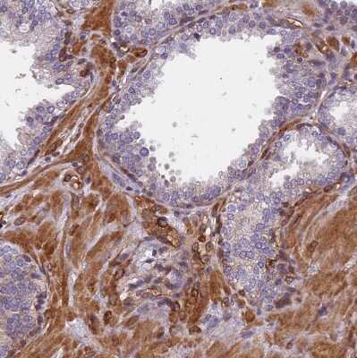 Immunohistochemistry-Paraffin EHBP1L1 Antibody - BSA Free