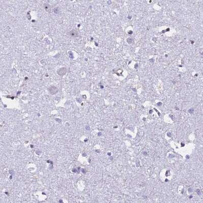 Immunohistochemistry-Paraffin EHBP1L1 Antibody - BSA Free