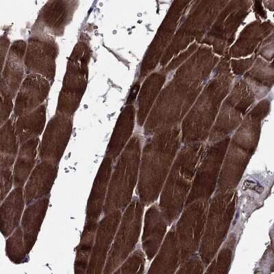 Immunohistochemistry-Paraffin EHBP1L1 Antibody - BSA Free