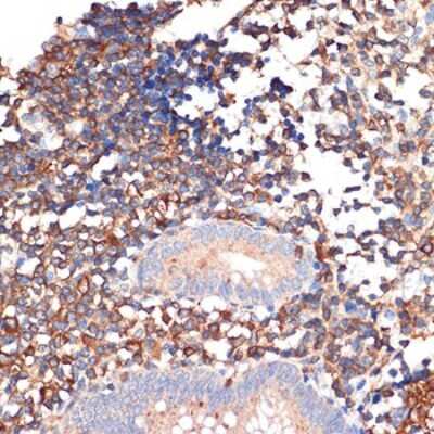 Immunohistochemistry-Paraffin: EHD1 Antibody (5S4P9) [NBP3-16201] - Immunohistochemistry of paraffin-embedded human appendix using EHD1 Rabbit mAb (NBP3-16201) at dilution of 1:100 (40x lens).Perform microwave antigen retrieval with 10 mM Tris/EDTA buffer pH 9.0 before commencing with IHC staining protocol.