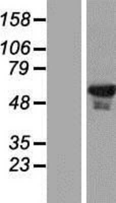 Western Blot: EHD1 Overexpression Lysate (Adult Normal) [NBP2-07580] Left-Empty vector transfected control cell lysate (HEK293 cell lysate); Right -Over-expression Lysate for EHD1.