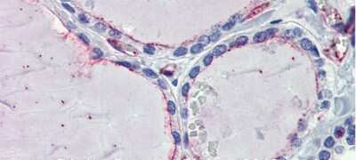 Immunohistochemistry EHD4 Antibody